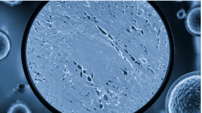 PESA & TESA — gallery image 6